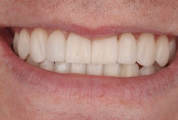 After - 2 Green Dental