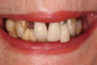 Before - 2 Green Dental